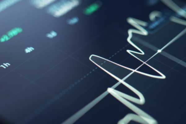 纽约梅隆银行称：对于长期投资者来说 美元走弱是一个买入机会